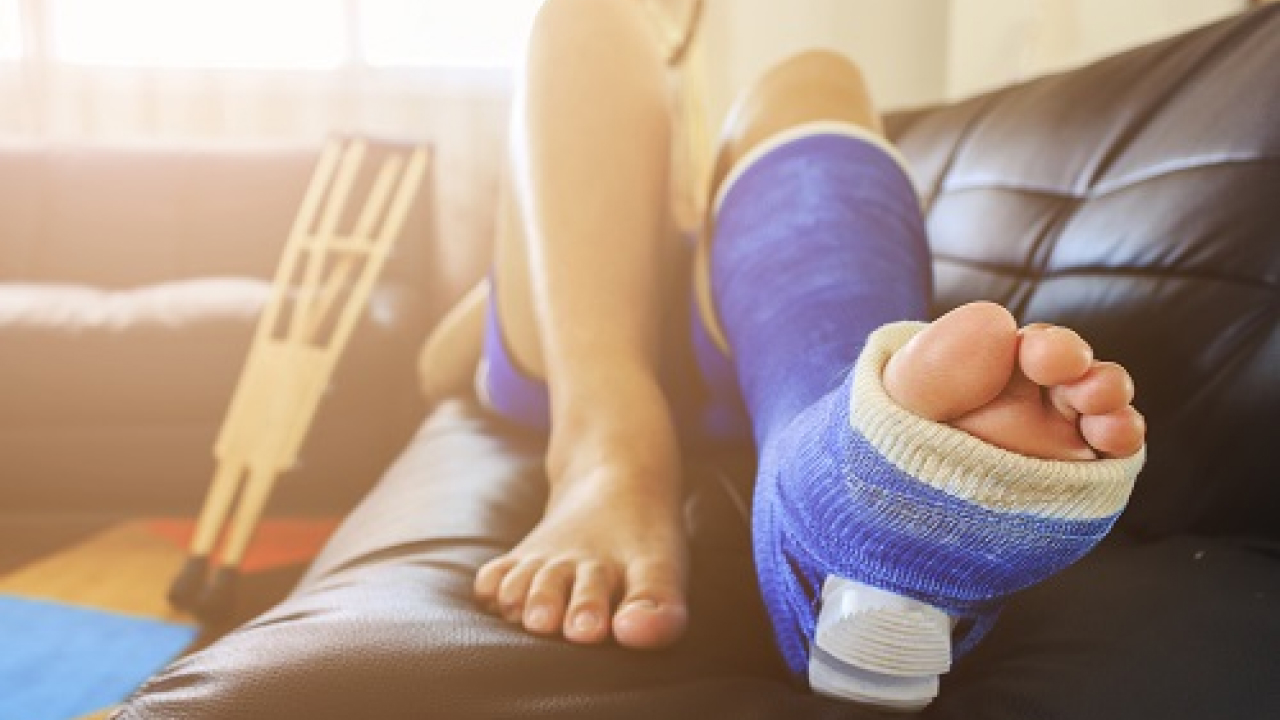 Broken Bones and Sprains in sports